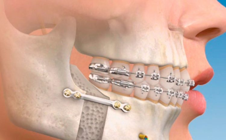  Problemas más comunes en cirugía maxilofacial